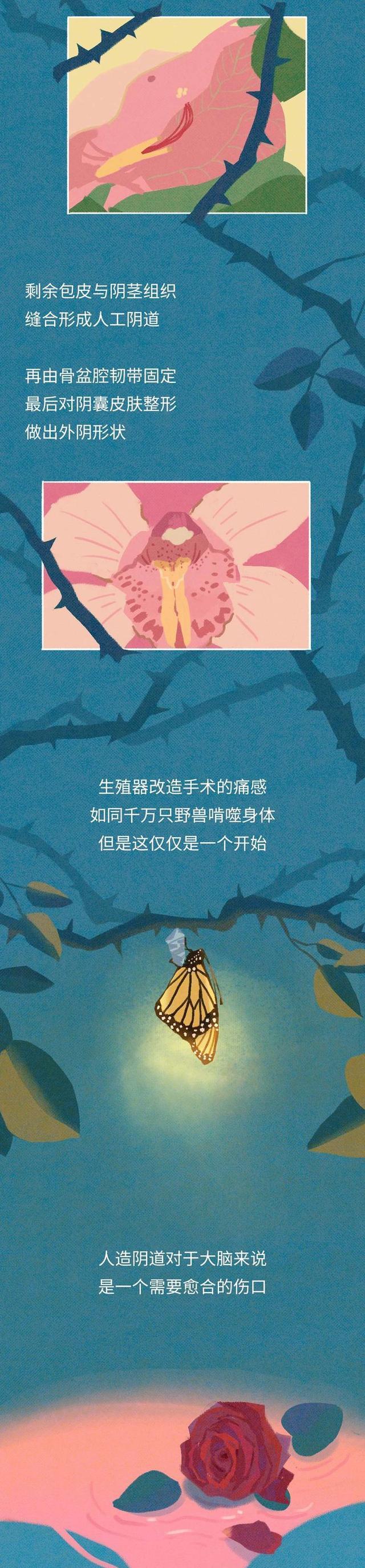 acgn漫评|男人真的能变成女人吗？（漫画揭秘）需要经过怎样的“过程”？