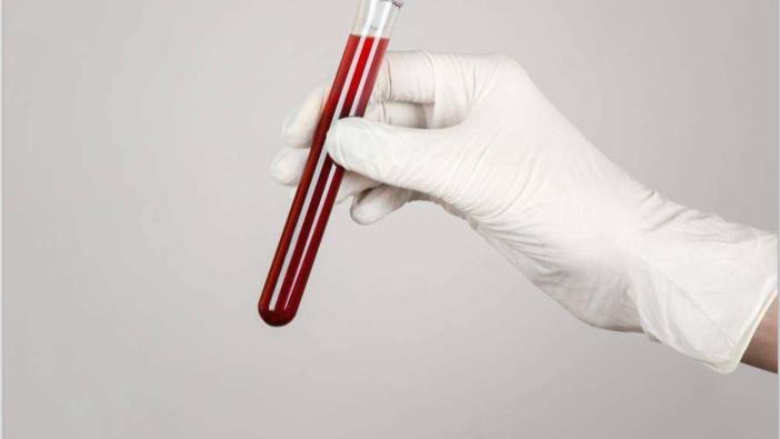 医生|血脂高，就不能吃肉了？提醒：想控制好血脂，需控制碳水的摄入量