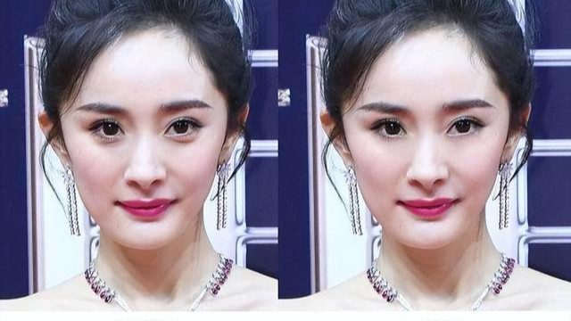 鸡蛋|纪实：女子用臀部真皮做卧蚕，手术却意外失败，男友见后：好恶心