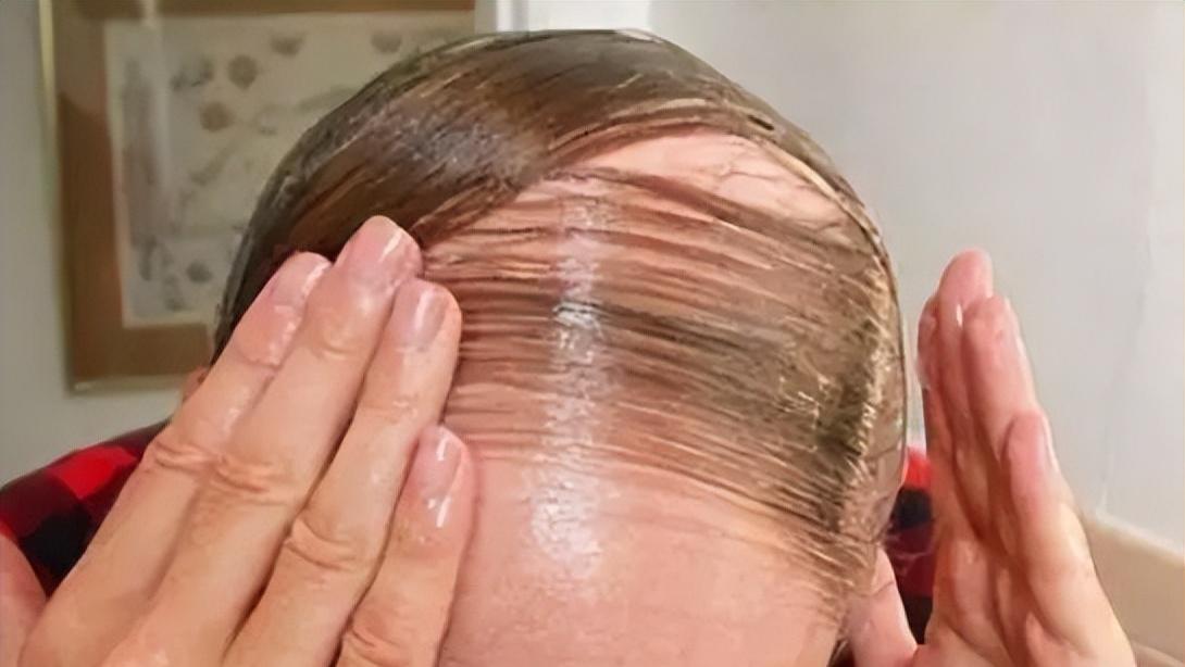 痰湿体质|防止脱发，那些坑人小妙招，秃得更彻底