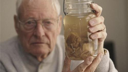 爱因斯坦|被博物馆收藏的名人器官：从爱因斯坦大脑，到爱迪生的最后一口气