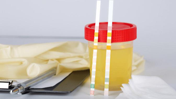 脑梗塞|肌酐涨到350多久会尿毒症？肾内医生给出3点建议帮你拖延时间