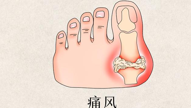 医生|“国庆长假”准备胡吃海塞？了解以下几点，放心吃。