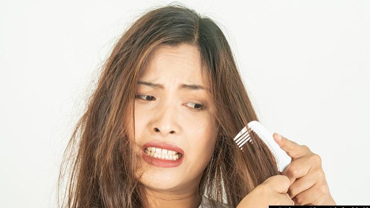 苹果 万万没想到！头发干枯、毛躁、蓬松等或与这种病有关！