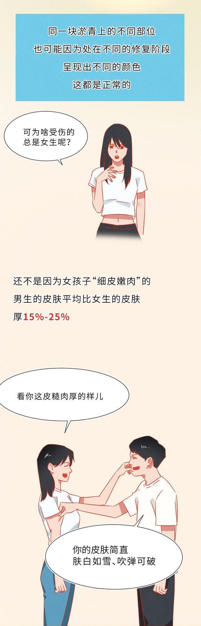 漫画|为什么女生的膝盖上总有“淤青”？一组漫画解惑，别不怀好意