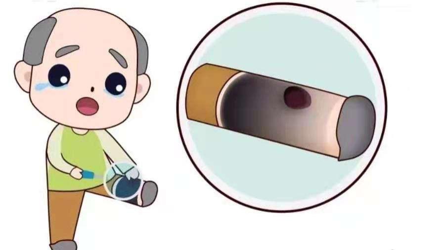 |老烂腿不能碰什么东西，一次性说清楚！