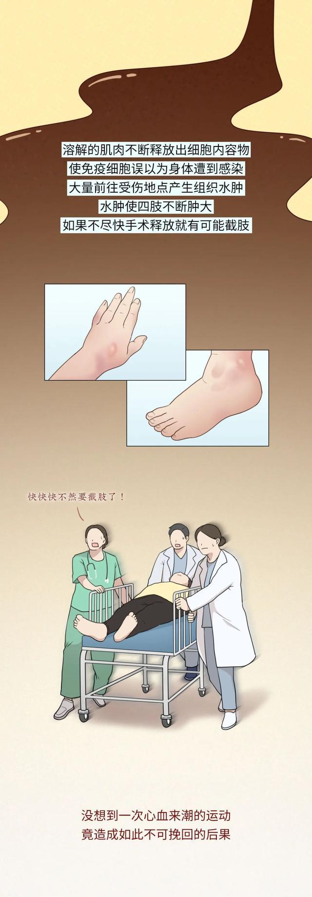 |“跟跳1小时刘畊宏毽子操，我手脚发麻、头晕眼花……”（漫画）