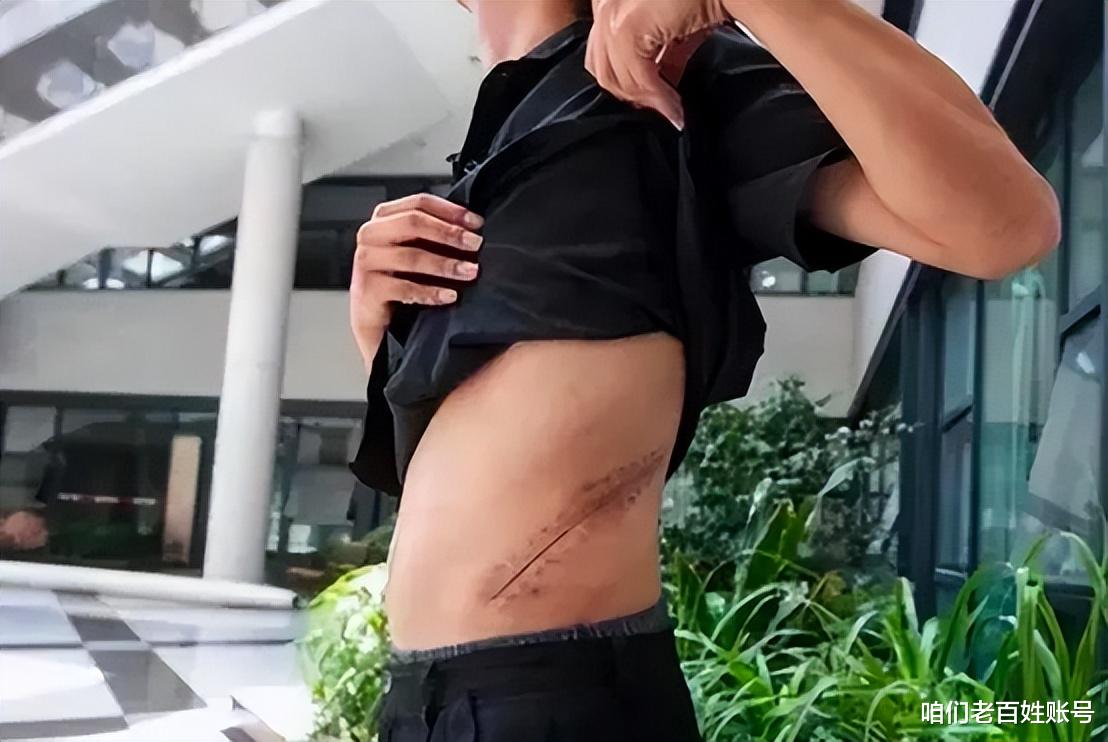 iPhone 14 Pro|10年前,那个卖肾去买苹果手机的湖南小伙,现状如何?