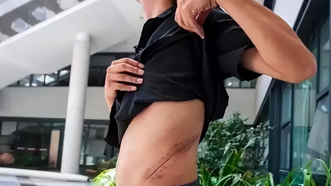 iPhone 14 Pro|10年前，那个卖肾去买苹果手机的湖南小伙，现状如何？