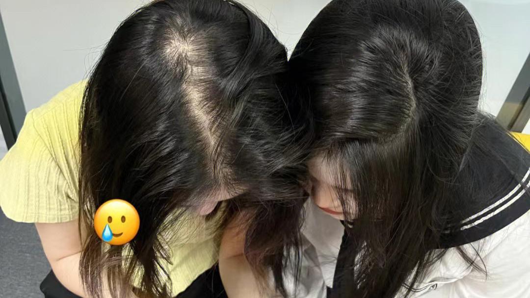 脱发|日常4个坏习惯，会导致掉发，建议大家：不想“早秃”，尽早改变