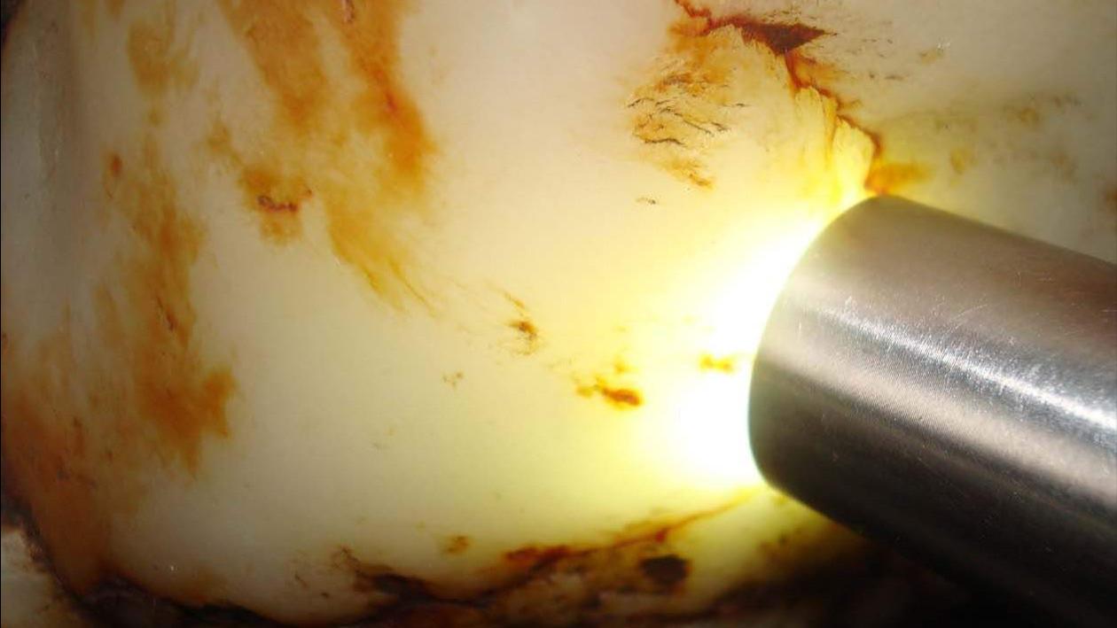 杭州|捡到宝？杭州一男子在工地捡一大石头，晶莹剔透，鉴定后让人难舍