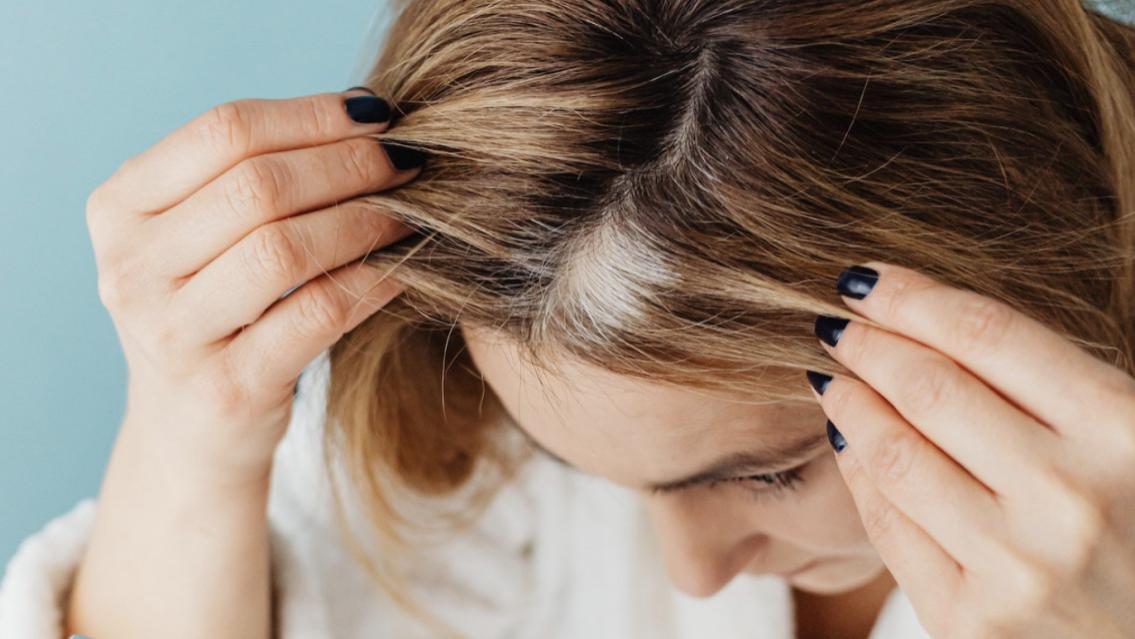 尼古丁|突然长白发，可能是身体里缺这5种东西，补回来，头发还能变黑