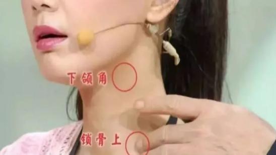 甲状腺疾病|多名院士联合呼吁：甲状腺激素异常，建议少吃“2黄”，多吃“2白”