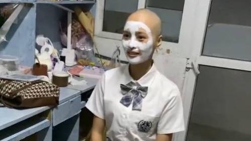 胆固醇|女学生频繁掉发索性剃成光头！剃光头真的可以防脱发吗？