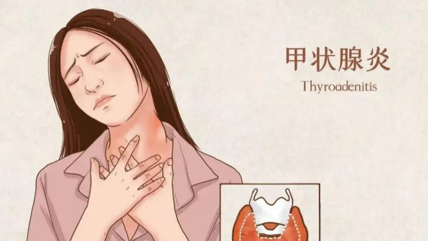 慢性腹泻|《柳叶刀》点名批评：“敷衍式”早餐，天天当成宝，甲状腺不烂才怪