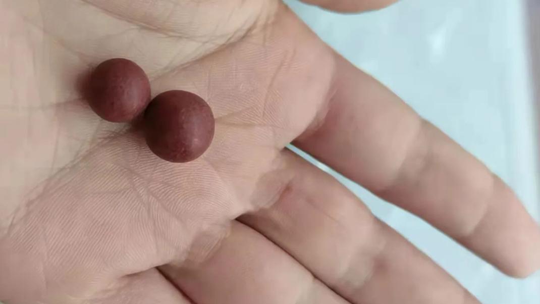 核糖核酸|科普：5种润肠通便的中成药，如你大便干结，毫无便意，不妨看完收藏