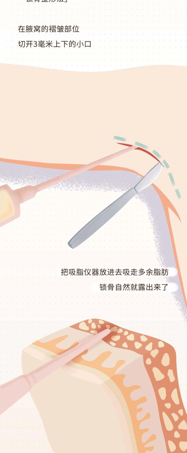 a4腰|从“A4腰”到「漫画腰」，女性为何总对身材“不满意”？（漫画）