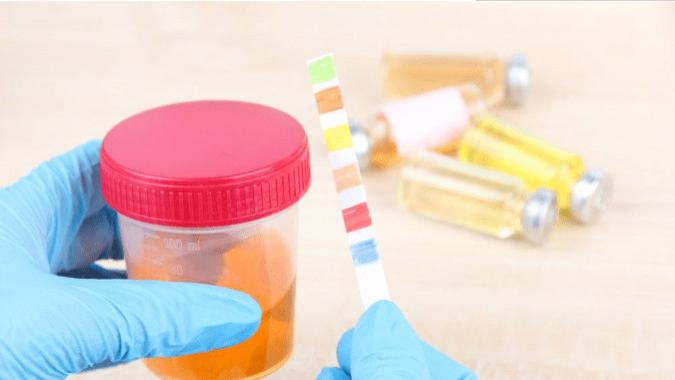 尿蛋白|“肾病刺客”尿蛋白频繁出没，记住这7点，可有效消除预防肾衰