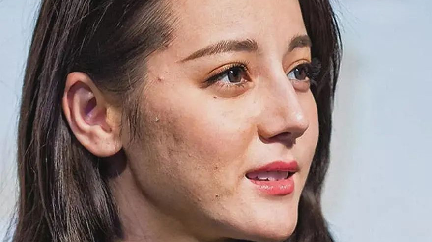 生图|精修是神颜，生图满脸痘，痘坑、黑眼圈、长斑，明星没那么美