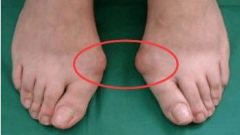疾病|脚趾头有4个症状, 可能是疾病的前兆