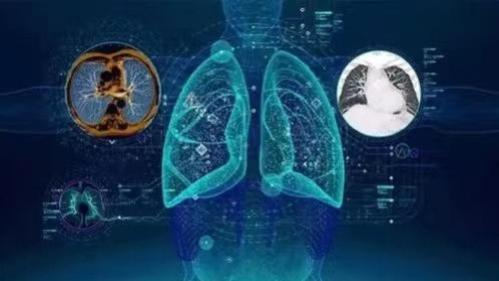 软件|陈根：帮助识别齿科疾病，人工智能影像诊断边界再拓宽