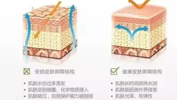 美肤医师郭金月：想要皮肤水嫩，该选择光子嫩肤还是水光？