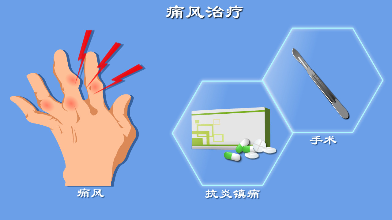 运动|痛风没得治？抗炎镇痛降尿酸？手术取石？痛风治疗门道多，全解读