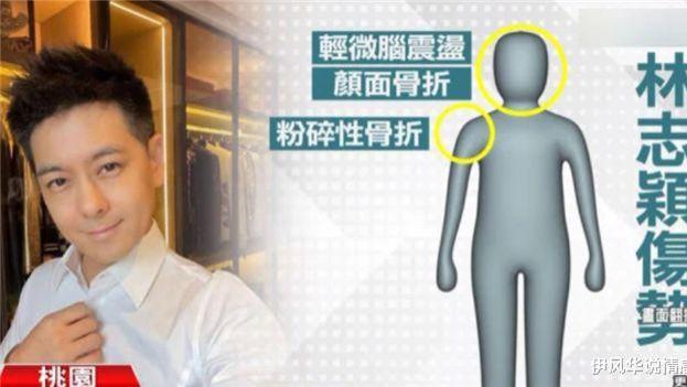 重症监护室|一波未平一波又起！林志颖仍在ICU治疗，如今又传来坏消息