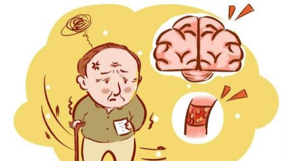 饮食|出现这些症状别轻心，很有可能是动脉硬化找上门了！