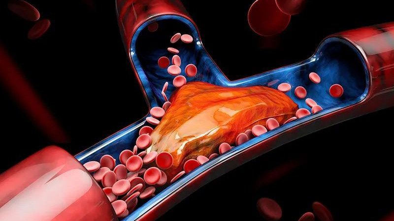 心脏|血管好不好，摸摸脚背就知道了