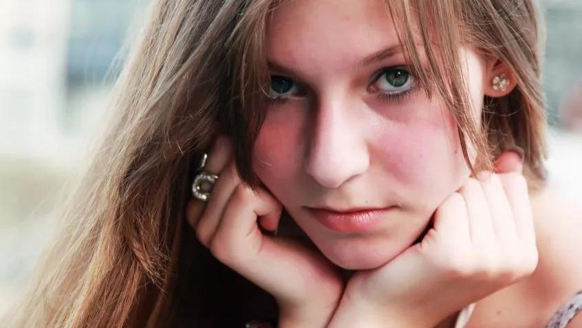 美甲 怎么去除痘痘最有效？一个简单小组合，战痘就此终结