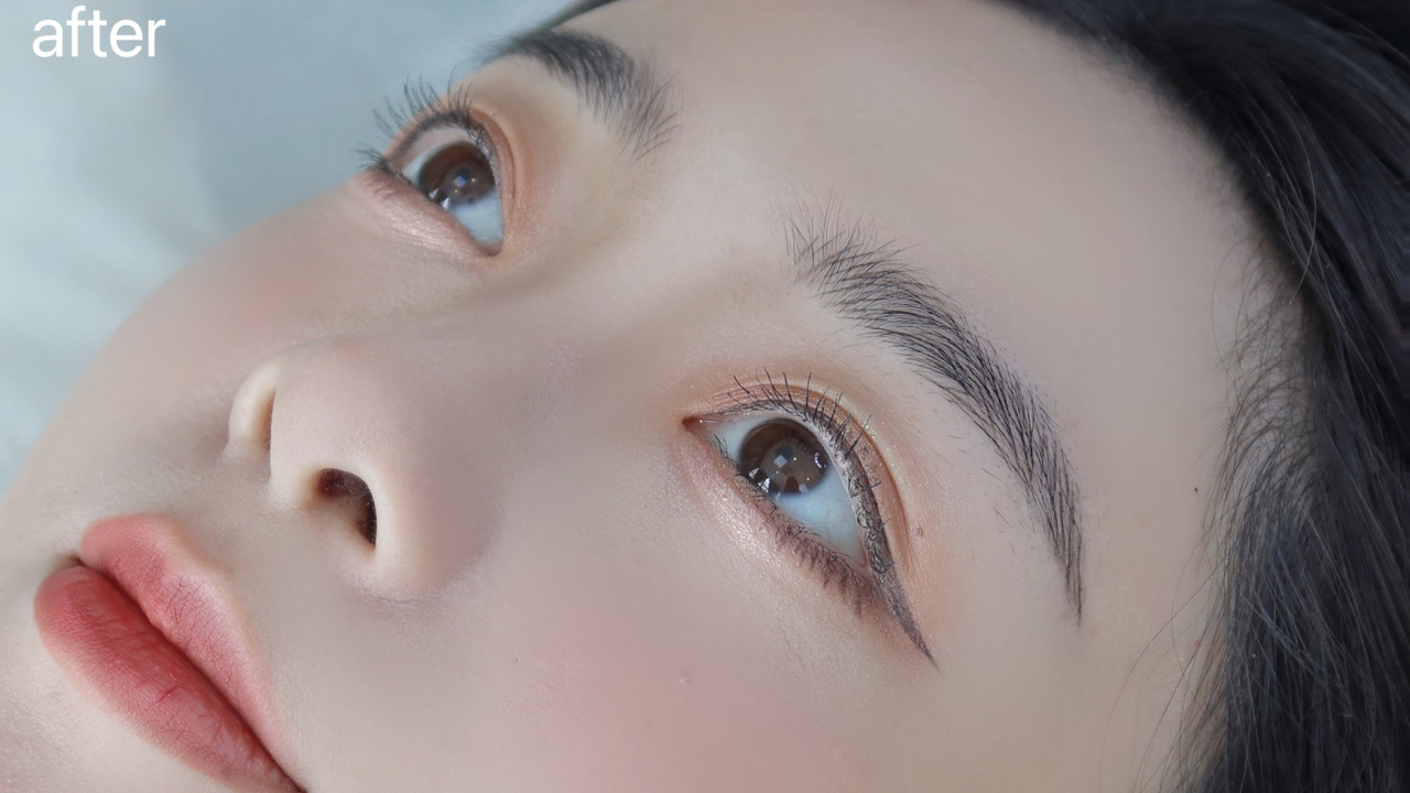 医美 35岁女人纹眉1年后，简直就像换了一个人一样，朋友都说真漂亮