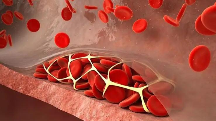 胆固醇|升脂“大户”被公布，鸡蛋排末尾，榜首胆固醇“成倍增”，很多人当补品