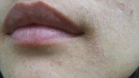 面霜 皮肤科医生忠告：超伤脸的4个行为，用再贵的护肤品也是浪费！