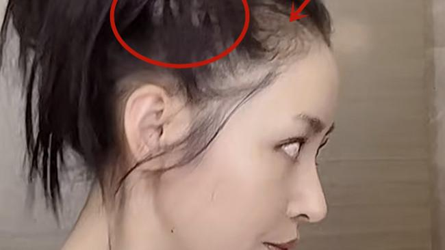 张天爱 张天爱素颜录视频，头发稀疏头皮隐现！吴谨言同样也深陷脱发危机