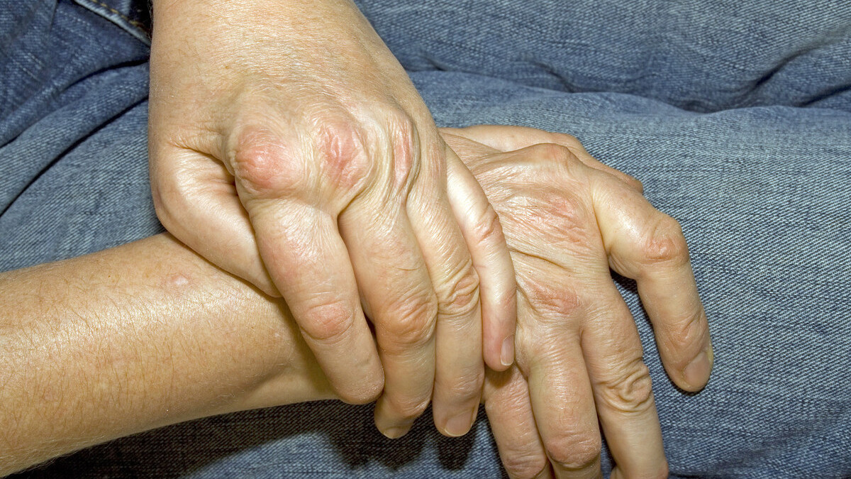 支气管炎|体内毒素有哪些？寒积、气积、痰积、血积、食积！一个名方消五积