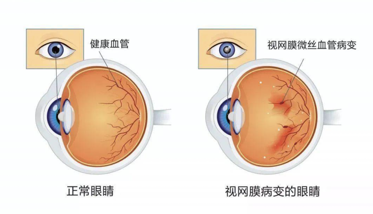 苹果|疫情下的慢病困境，医疗AI能破局吗？