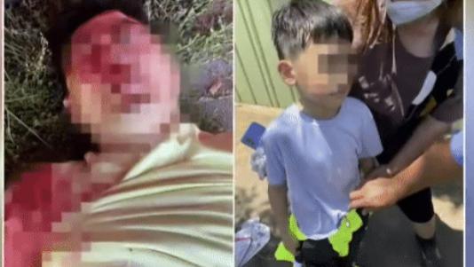 林志颖|林志颖几次挣扎想起身，市民称儿子平安才躺下，建模修脸或1年