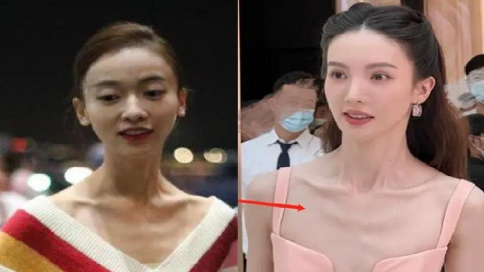 连衣裙 “内卷”下7位暴瘦的女明星，有的瘦到54斤，有的体力不支坐轮椅