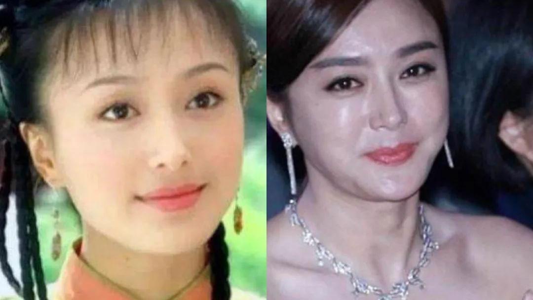 写真|那些打过美容针的女星怎样了？活得像假人，一堆后遗症！