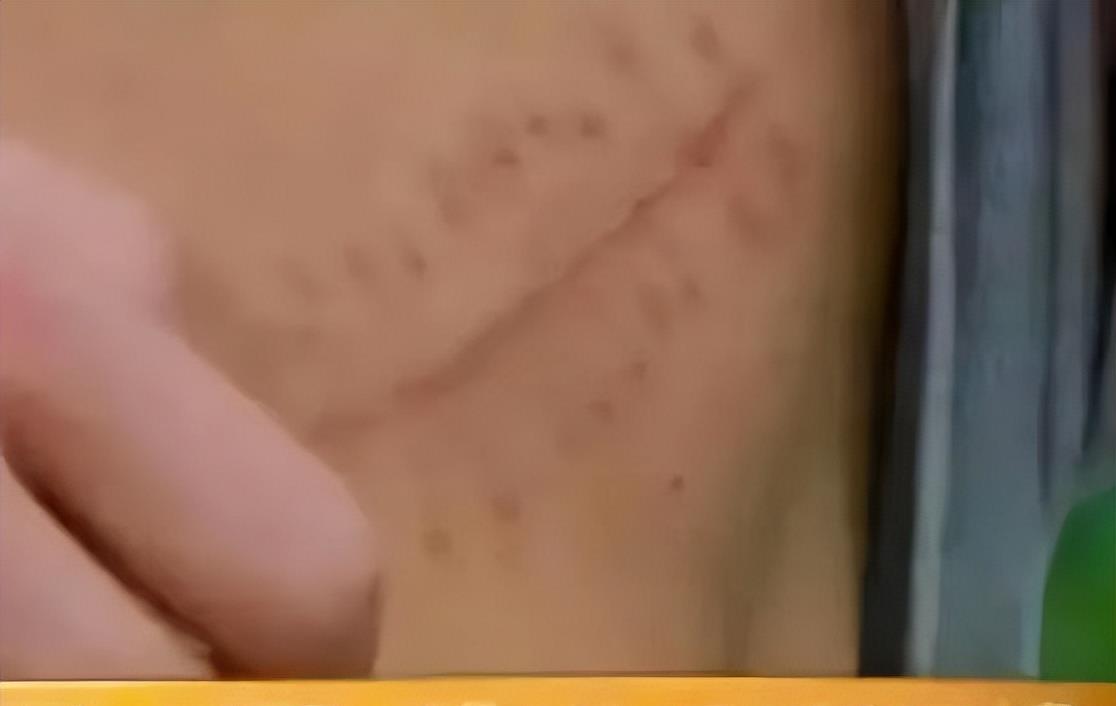 浏览器|11年前，卖肾换手机的少年王刚，现在怎样