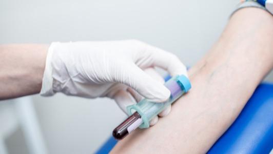 鸡蛋|高血脂不能吃鸡蛋？医生忠告：不想血脂飙升，这3“白食”趁早忌口