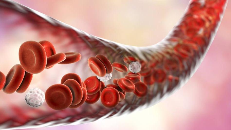 橄榄油|想要血管畅通健康，一定做好2件事，尤其第一件，家家厨房里都有！