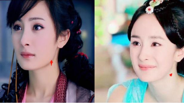 陈哲远|双下巴、颧骨凸出、面中凹陷，5位明星“换头”成功，缺陷也太明显