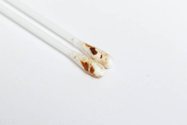 耳屎的作用, 别忽视, 为什么60岁以上的老人中, 有耳鸣者达1/10