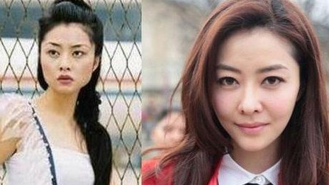 熊黛林|“整得最成功”的5位女星，脸上不知道动过多少刀子，却毫无痕迹！