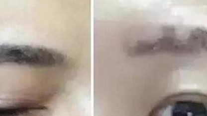 蜂蜜 千万别再跟风去纹眉，背后的危害现在知道还不迟，有可能少活十年