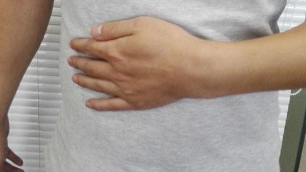 胃癌|胃癌可能是“拖”出来的，若是出现这5个“求救信号”，须小心