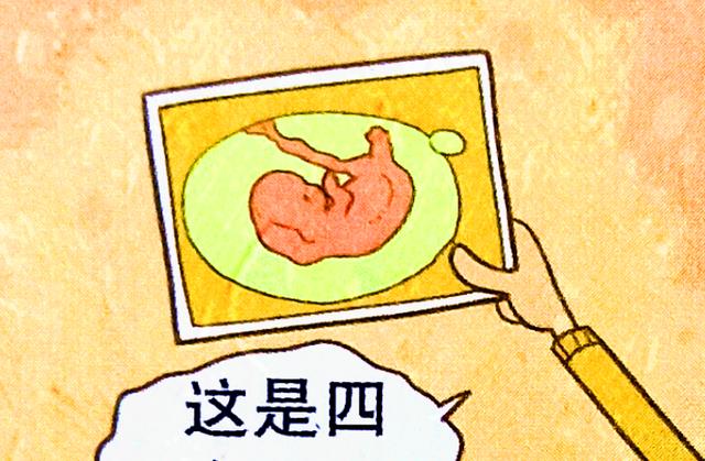 漫画|小衰拿出“童年旧照”，同学们却直呼“辣眼睛”！