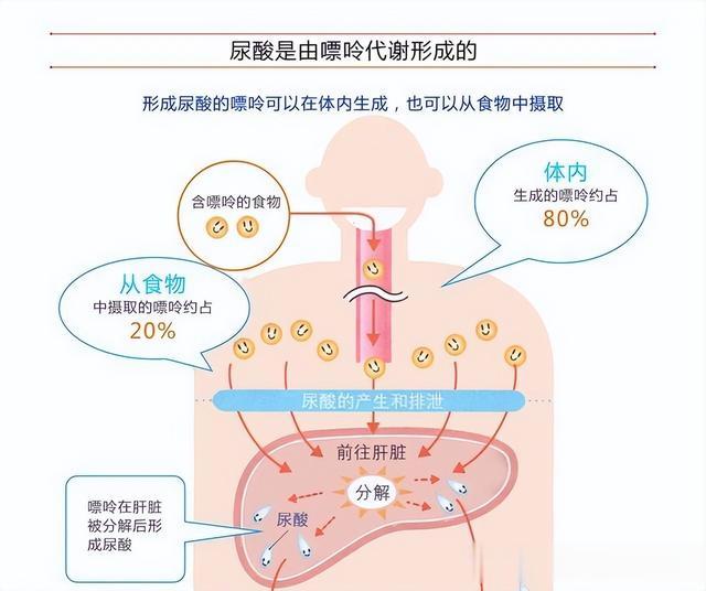尿酸高, 该如何让尿酸排出体外? 总结3个办法, 实用有效